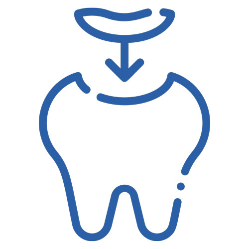 fillings